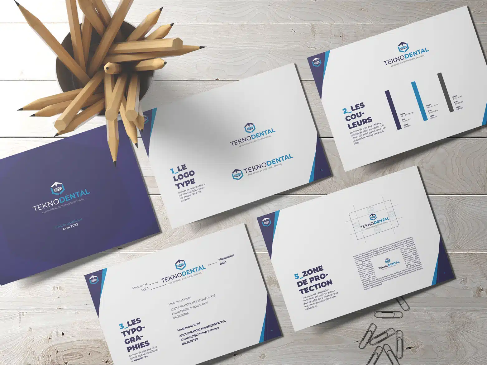 Teknodental à Nevers, laboratoire de prothèse dentaire